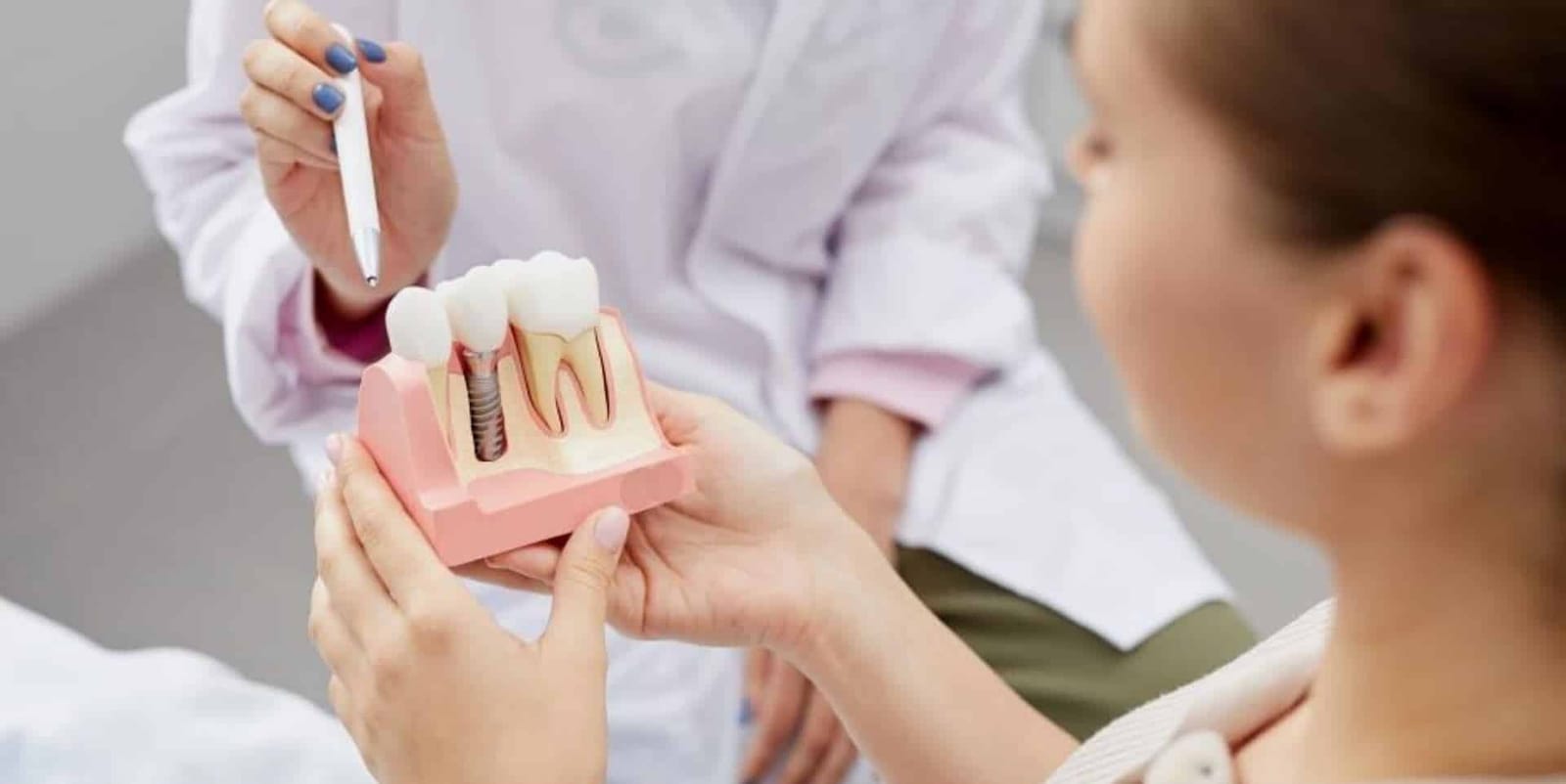 Osoba prowadząca leczenie pokazuje pacjentce model implantu