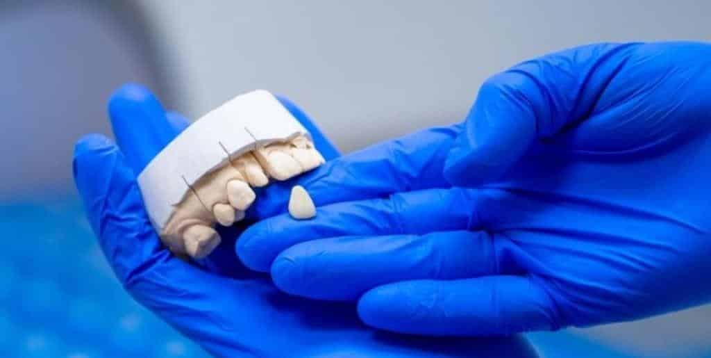Dłonie w rękawiczkach trzymają model uzębienia i uzupełnienie w kształcie zęba