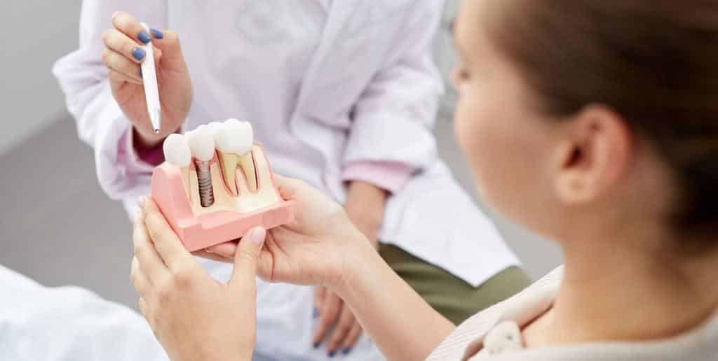 Dentysta objaśnia budowę implantu na modelu zęba