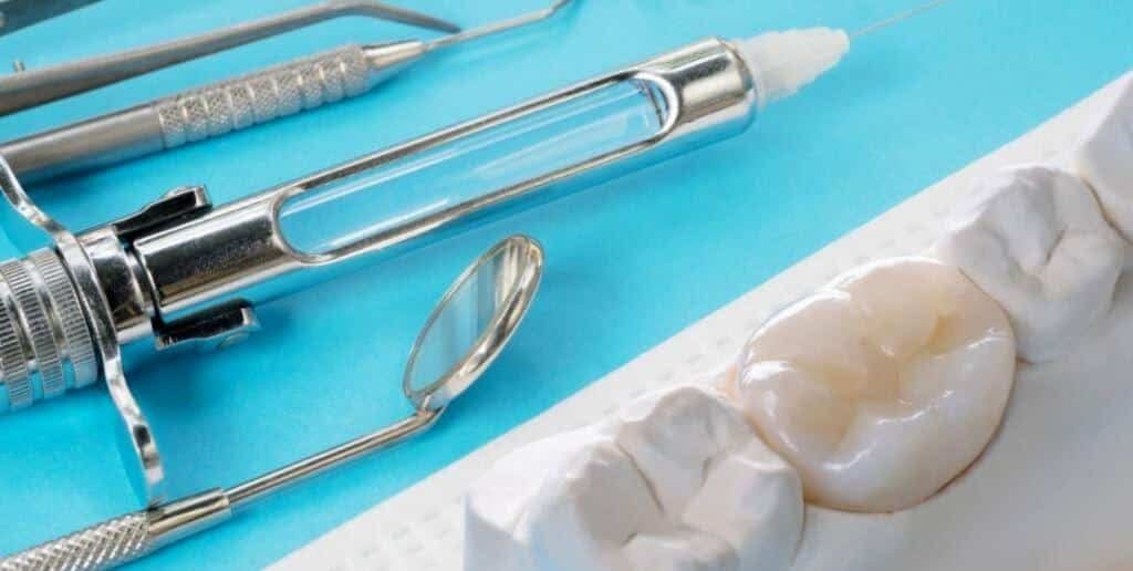 Model zęba i korona obok strzykawki i narzędzi stomatologicznych