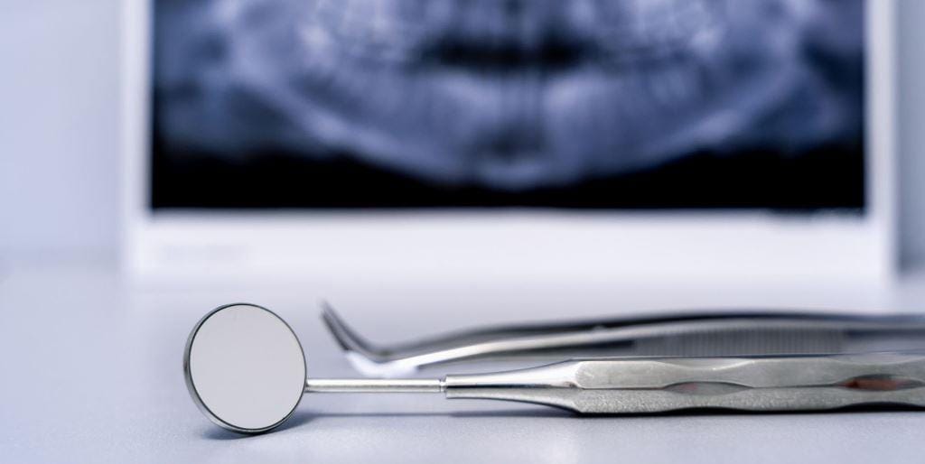 Instrumenty stomatologiczne obok ekranu ze zdjęciem rentgenowskim zębów