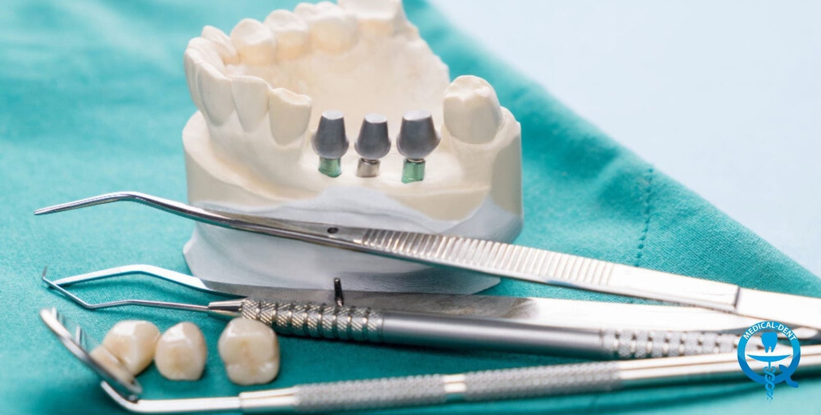 Model z elementami implantu i koronami obok narzędzi