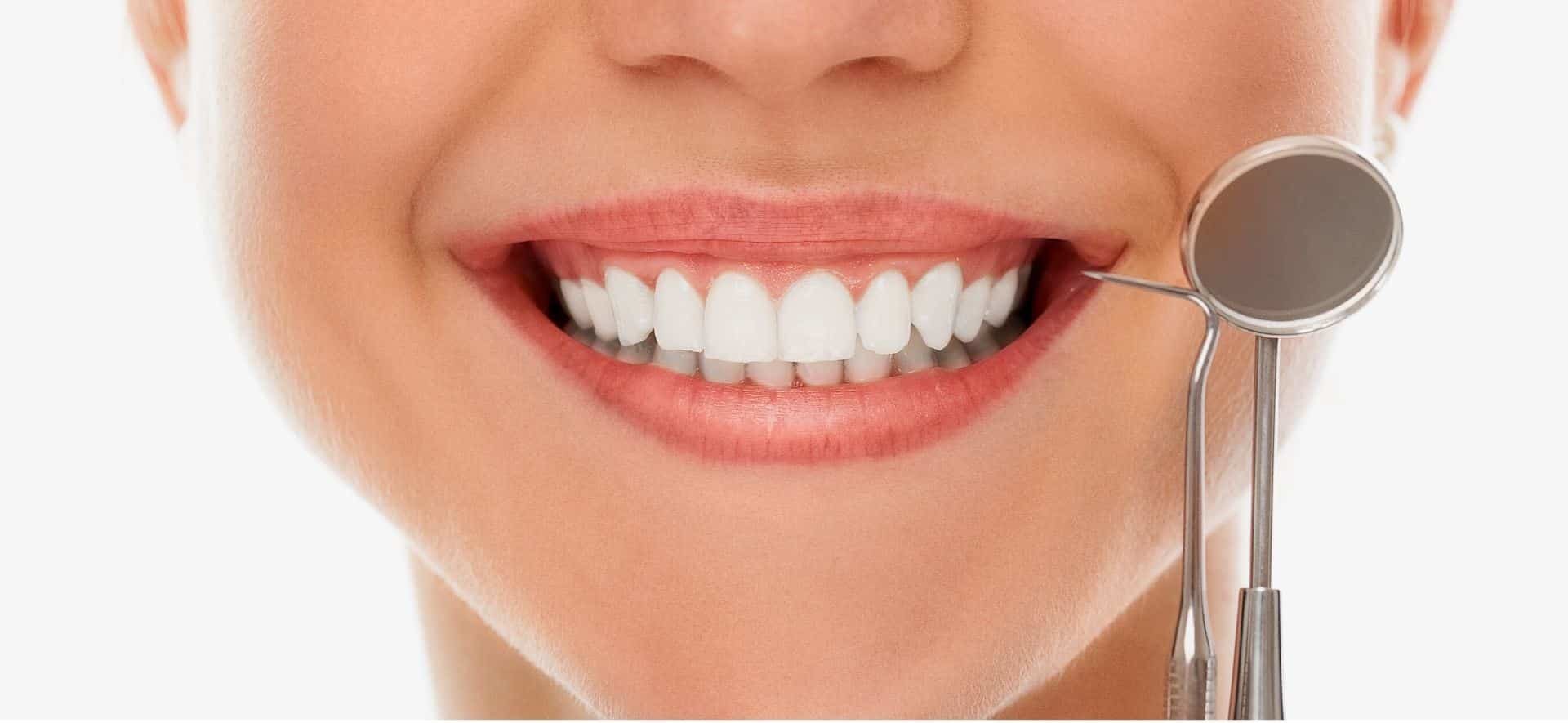 Imaginea prezintă o față zâmbitoare, cu dinți perfect albi, uniformi și o oglindă dentară încercată pe gură. Imaginea sugerează o vizită la dentist pentru un control sau un tratament al dinților.