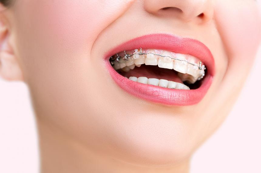 Orthodontic treatment - frequently asked questions