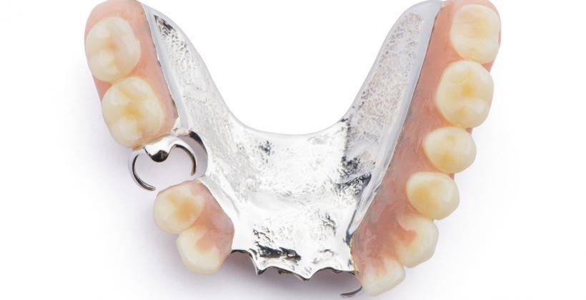 Obraz przedstawia metalową, U-kształtną protezę szkieletową z umocowanymi sztucznymi zębami. Protezy takie są stosowane w leczeniu dentystycznym jako uzupełnienie brakujących zębów u pacjentów. Protezy zbudowane są z metalu w kształcie podkowy, do którego przymocowane są sztuczne korony zębów z materiału imitującego naturalny wygląd zębów.