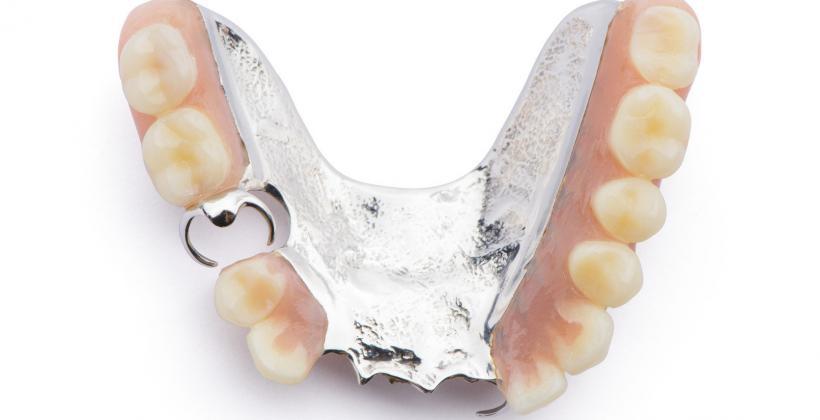 denture framework dentist uk