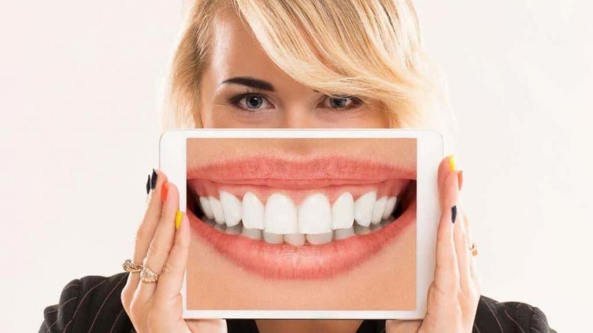 Dental veneers in the UK. Everything you need to know