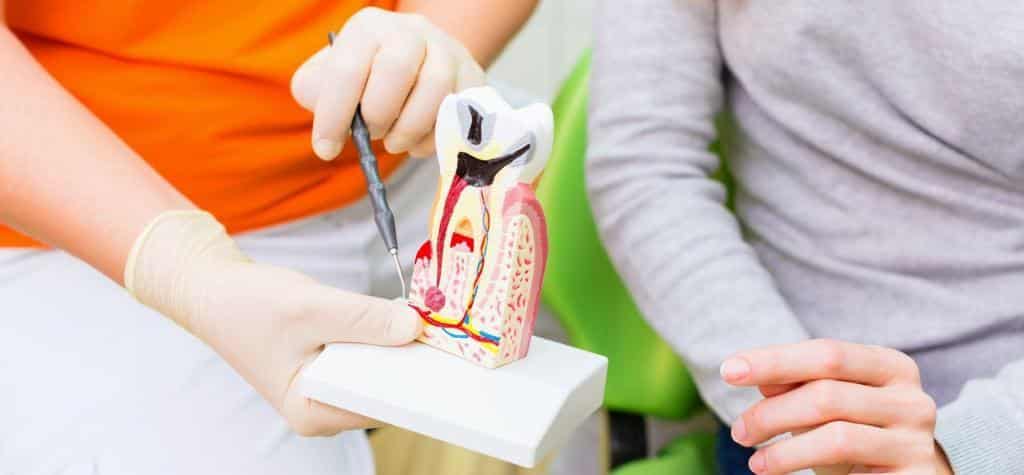 Root canal treatment in the UK