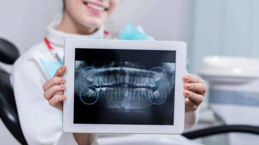 Problematic eighths - facts and myths about wisdom teeth Problematic eighths - facts and myths about wisdom teeth
