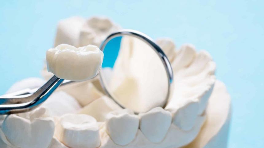 Crowns for teeth in the UK - everything you need to know