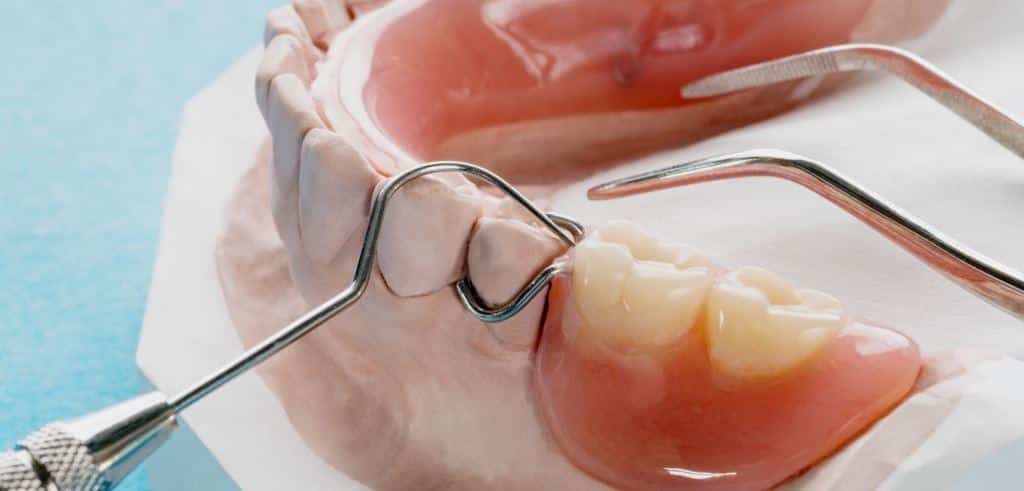Skeletal dentures for teeth