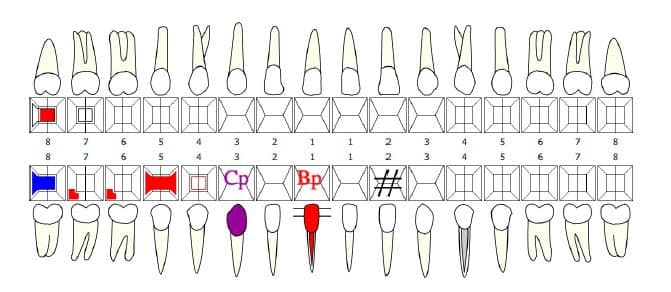 Dental treatment plan 