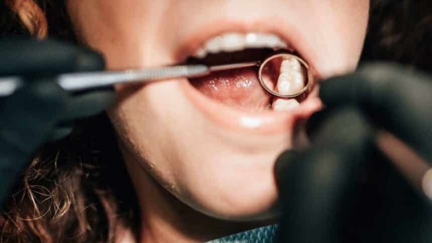 Запълване на зъб в Обединеното кралство - видове пломби в Обединеното кралство и техните цени