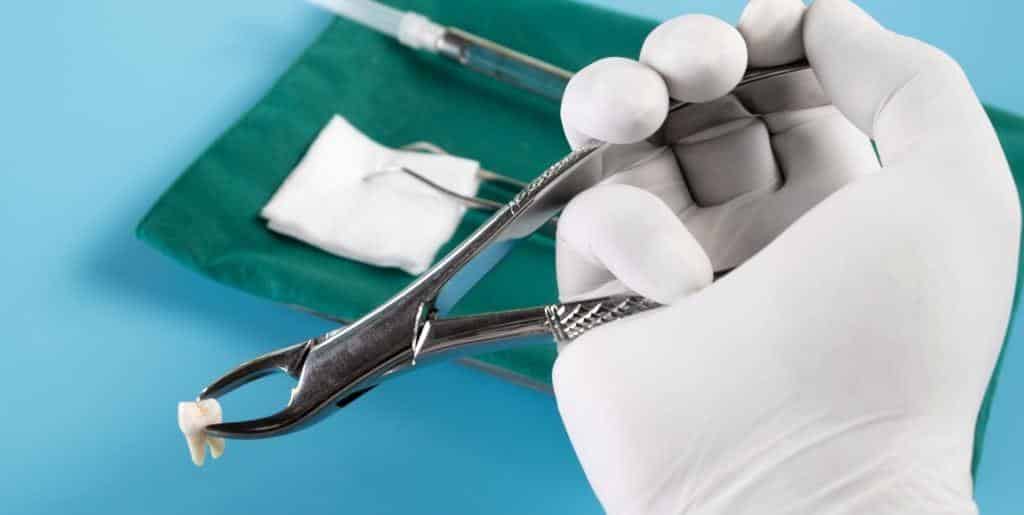 How does a tooth extraction procedure work in the UK?