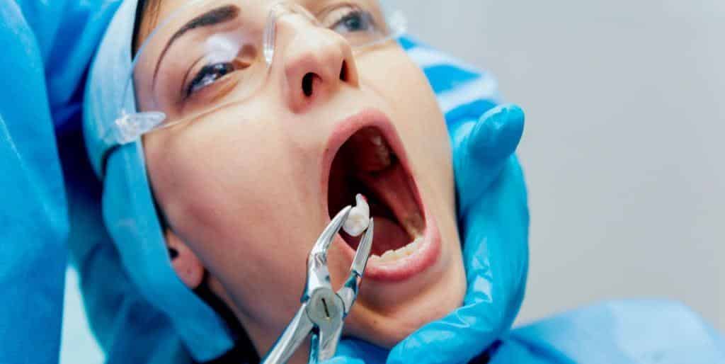 Extraction of a tooth in the UK - indications