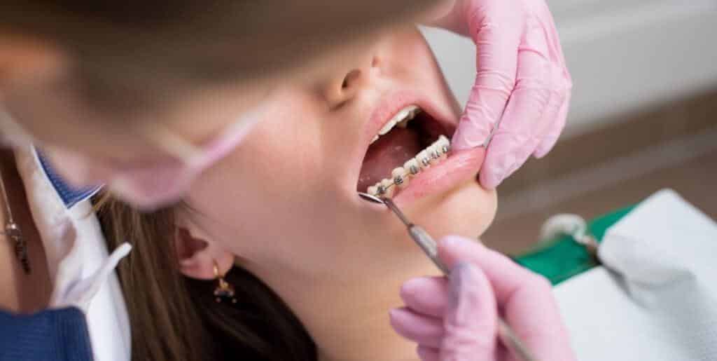 Orthodontic treatment in the UK