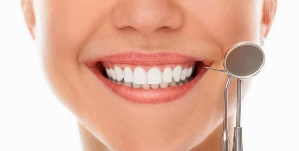Koľko stojí bielenie zubov vo Veľkej Británii?