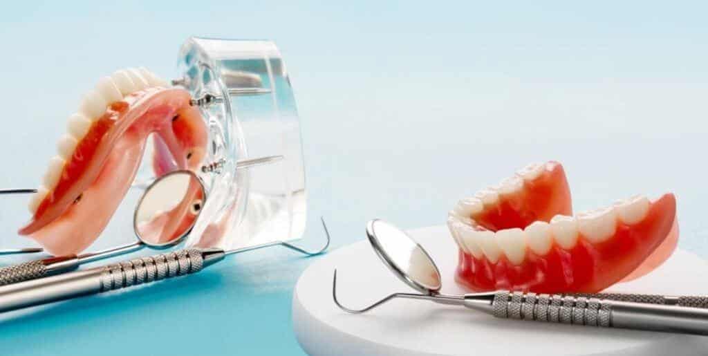Acrylic dentures in the UK - indications, process and price