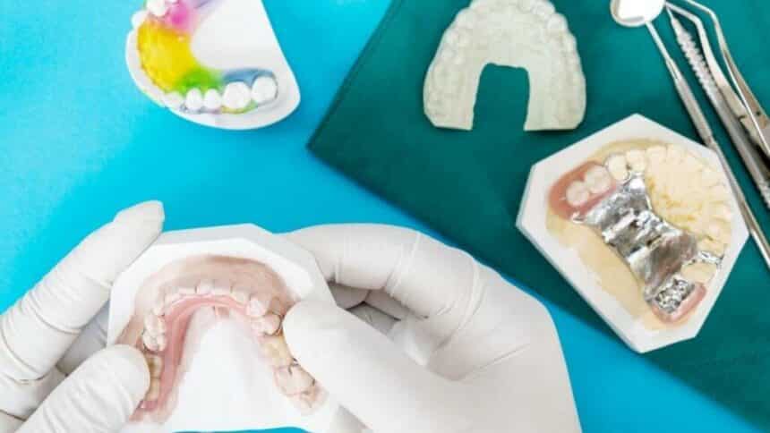 Skeletal dentures in the UK - indications, construction and price