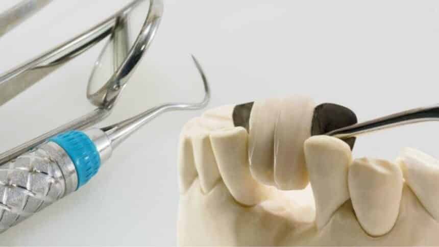 How much does it cost to have a tooth inserted in the UK? How much does it cost to have a tooth inserted in the UK?