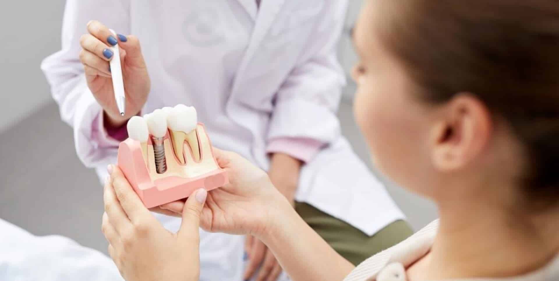 Prezentacja modelu implantu pacjentowi