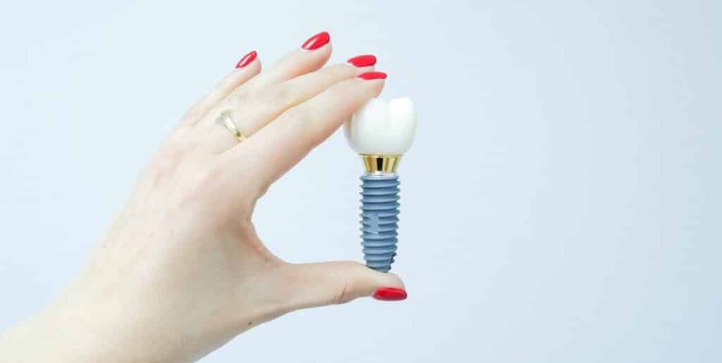 Dental implants in the UK