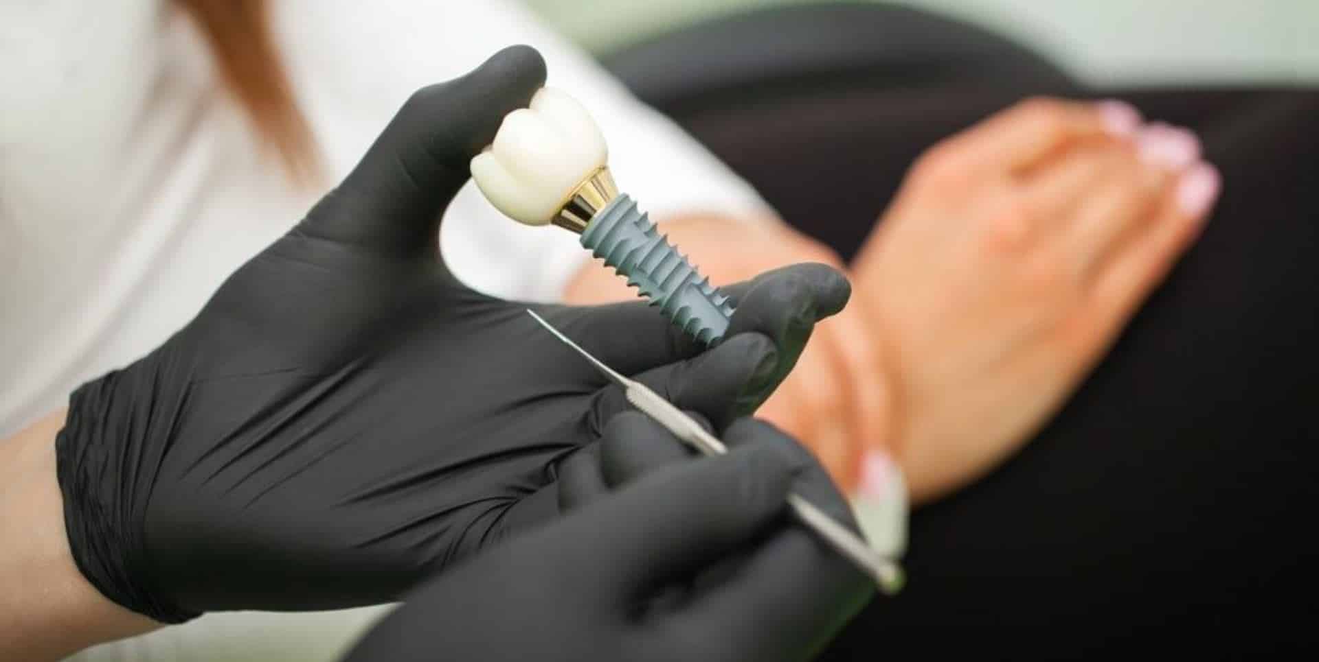Dłonie w rękawiczkach trzymają model przy pacjencie