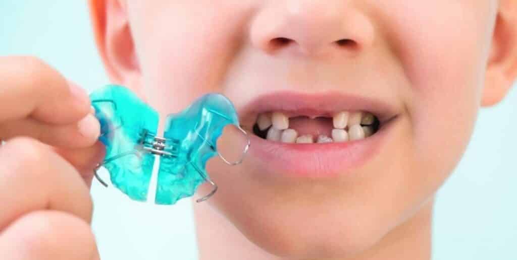 Braces for children