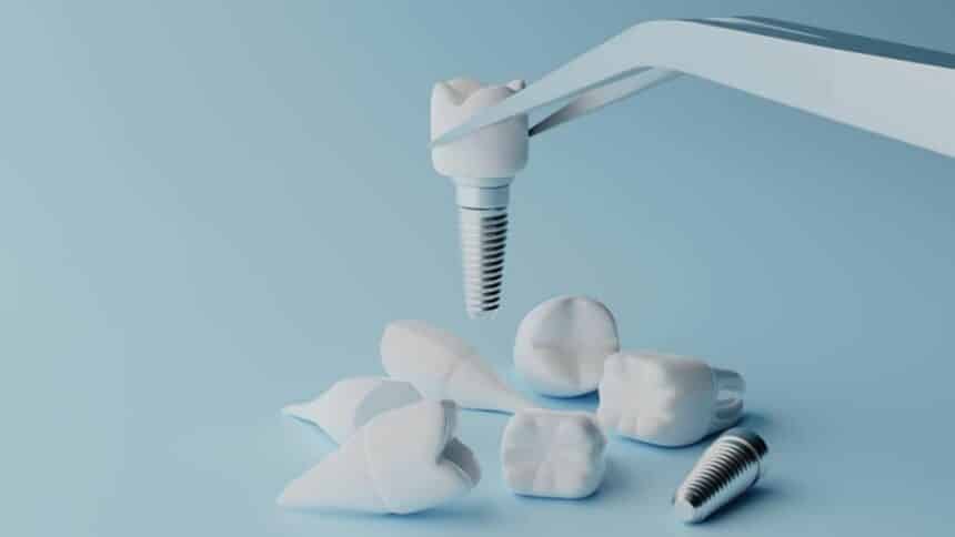 What does the price of a tooth implant in the UK depend on and how much does a tooth implant cost in the UK?