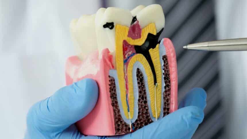 Tooth decay - where does it come from, how to treat and prevent it?