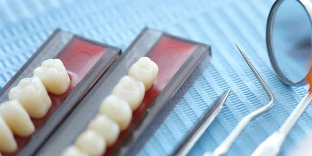 How much does a dental crown cost in the UK and what does the price depend on?