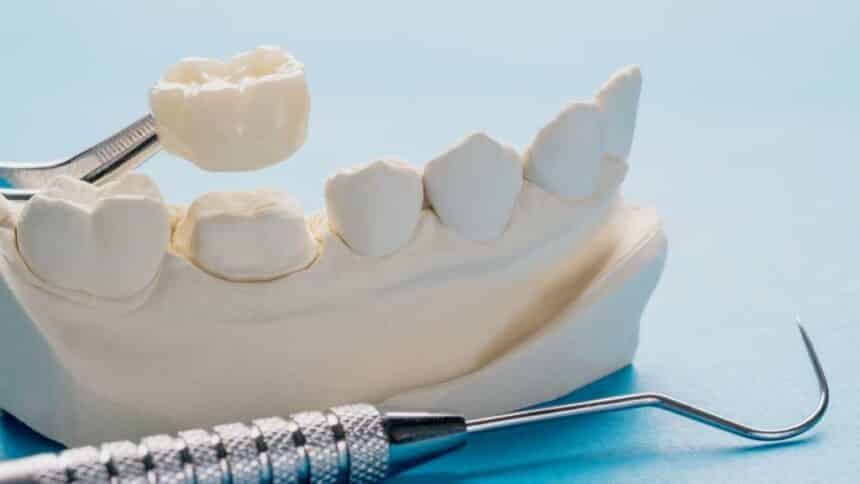 What does tooth restoration involve?