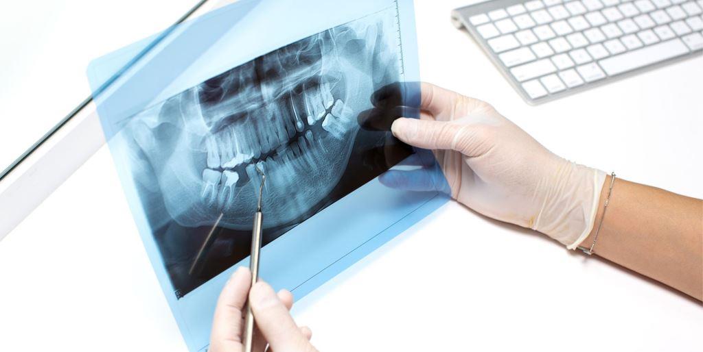 Dental anaesthesia at the dentist in the UK 