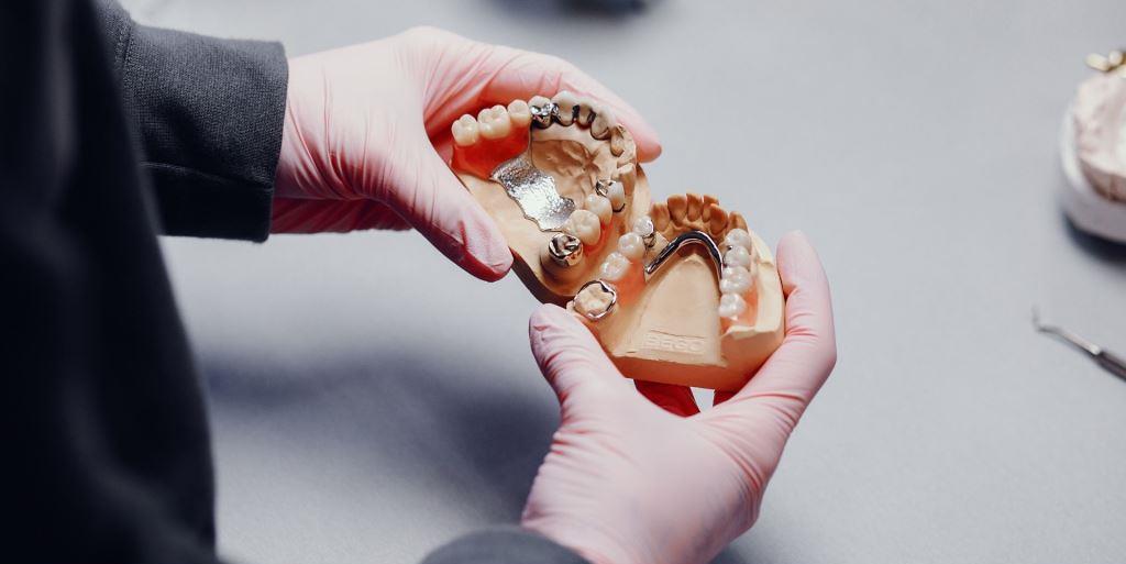 în locul unui implant, o proteză dentară