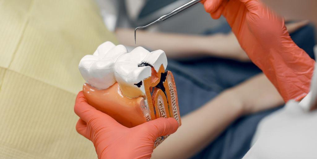 Pieskovanie zubov v Spojenom kráľovstve - pre koho je vhodné? 