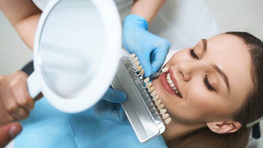 How much do veneers cost in the UK?