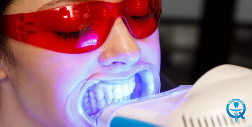 Teeth whitening with an LED lamp - what does it involve and how much does it cost?