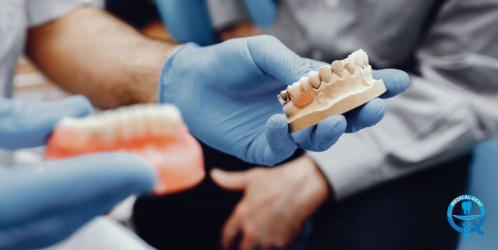 Mâini cu mănuși medicale albastre care țin în mână un model din ghips al unui maxilar dentar. În fundal sunt vizibile elemente neclare ale cabinetului stomatologic.