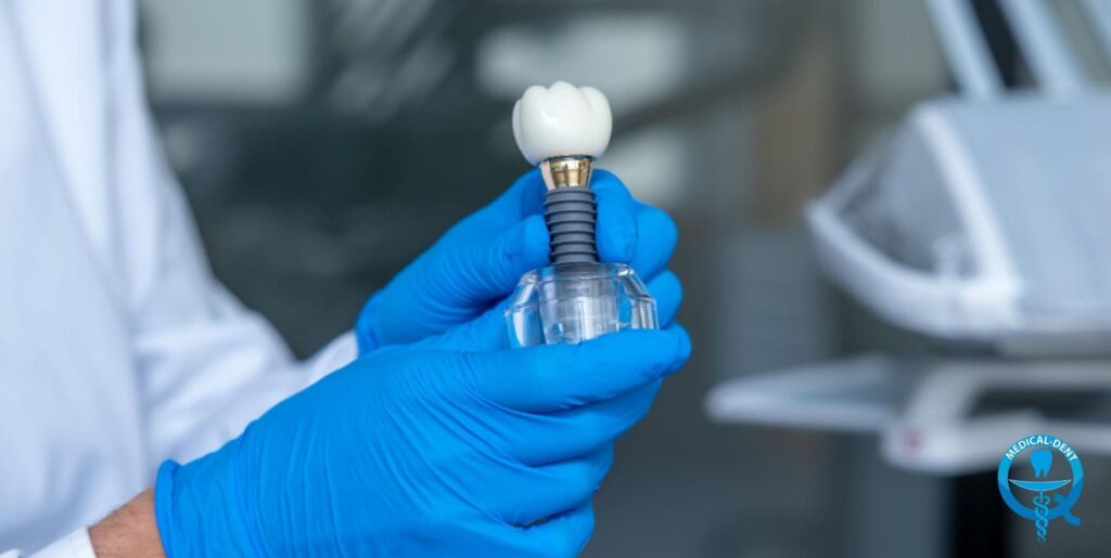Dłoń w niebieskiej rękawiczce medycznej trzymająca implant dentystyczny z białą koroną zęba na tytanowym trzpieniu. W tle nieostre wyposażenie gabinetu stomatologicznego. W prawym dolnym rogu logo Medical-Dent.