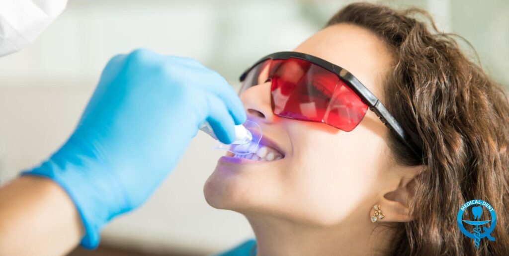 "Patient wearing red safety goggles during teeth whitening treatment. Dentist wearing blue glove places whitening instrument in patient's mouth. The logo of the dental clinic is visible in the lower right corner."