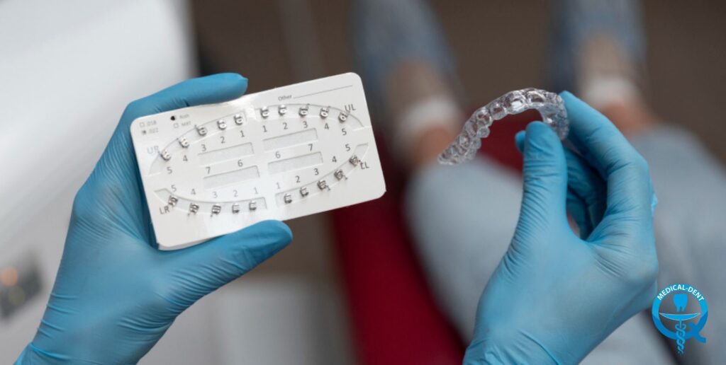 Dłonie w niebieskich rękawiczkach medycznych trzymające kartę dentystyczną z numeracją zębów oraz przezroczystą nakładkę retencyjną po leczeniu ortodontycznym. W prawym dolnym rogu widoczne logo stomatologiczne.