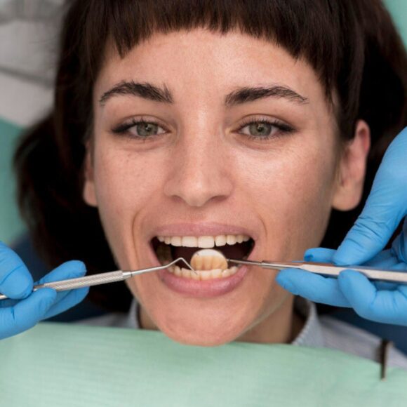 Získanie výplne v Spojenom kráľovstve - možnosti a cena