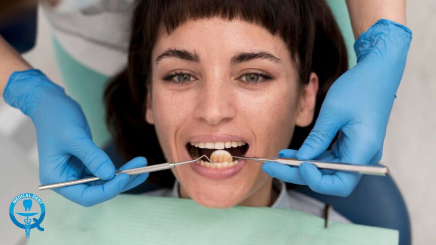 Získanie výplne v Spojenom kráľovstve - možnosti a cena Získanie výplne v Spojenom kráľovstve - možnosti a cena