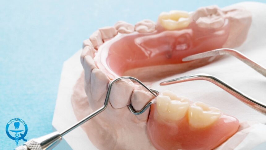 Proteze temporare - tot ce trebuie să știți