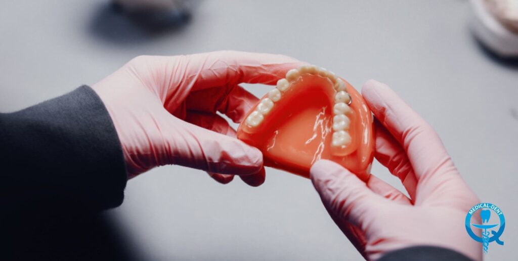 Mâini cu mănuși medicale roz care țin o proteză temporară superioară cu bază acrilică roz și dinți falși albi, prezentată pe partea palatală.