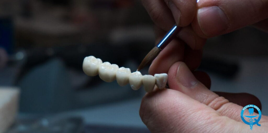 A dental technician holding a ceramic dental bridge in his hands and finishing it with a fine brush in the prosthetics laboratory.